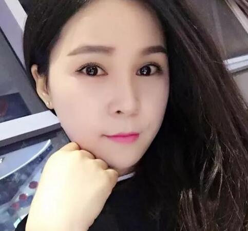 祛斑方法分享:43岁妇女变少女,肌肤白皙水嫩,老公儿子不敢认